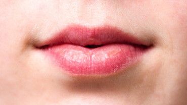 Was ist Lupus erythematodes?